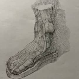 Стопа экорше.